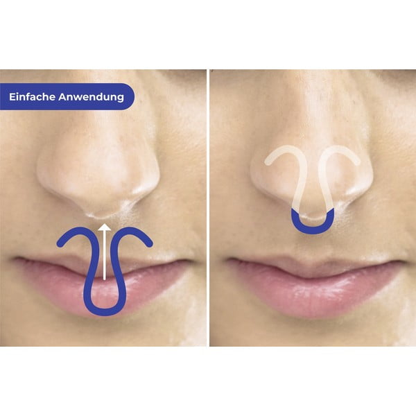 Knarkimą slopinantys segtukai komplekte 3 vnt. – Maximex-image-1